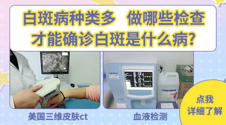 腿上出现形状不规则的白块是什么