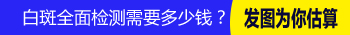 手上起白点如何判断是不是白癜风