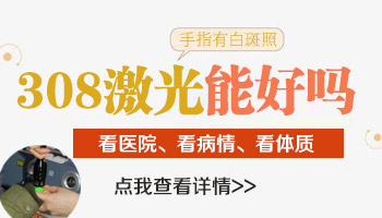 手指头上的白癜风能照射308激光吗