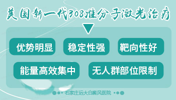 手指头上的白癜风能照射308激光吗