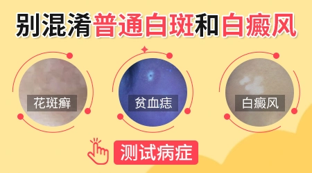 手指有白斑是什么原因