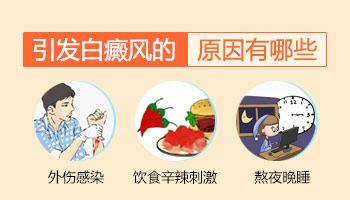家里没有白癜风遗传史为什么宝宝长白斑