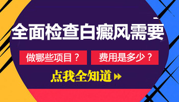 系统检查白癜风的发病原因需要花多少钱