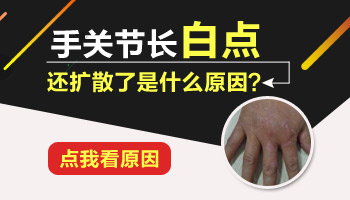 手上起小白斑什么原因 做哪些检查能查到病因