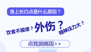 为什么身上会有白点 白点的患病原因