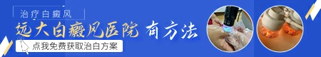 白斑是怎么引起的 治疗白斑有哪些方法