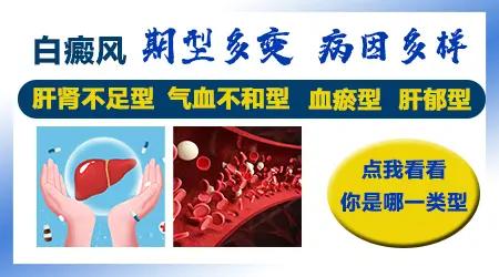 早期白癜风的病因