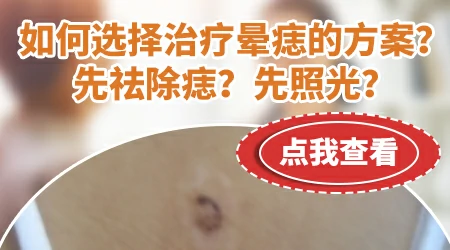 晕痣型白斑是因为什么引起的