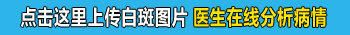 白癜风由白色变成粉红色是怎么回事