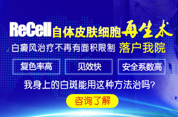 有白癜风能不能从事食品加工的工作