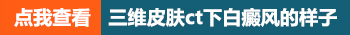 308激光照完了黑了是剂量太大吗