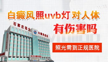 uvb光疗仪治白癜风有什么危害性