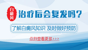 脸部白癜风照308恢复后又复发是什么原因