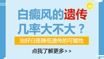 白癜风长在胸上遗传几率高吗