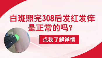 照完308后发红发痒是什么情况