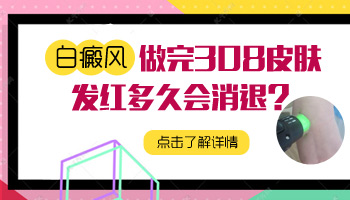 脸部白癜风做了308激光后红几天