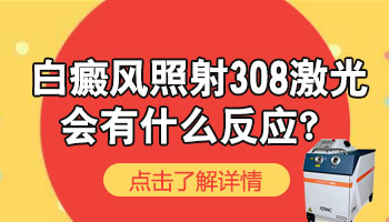 白癜风用308照射后出现掉皮正常吗