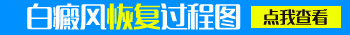 脸部白癜风会不会大面积的扩散