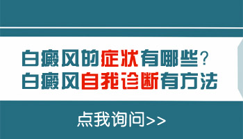 脸上一块白抹起来光滑是白癜风吗