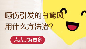 晒伤后长的白斑就一定是白癜风吗