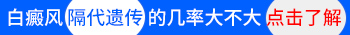 白癜风三代遗传几率有多大