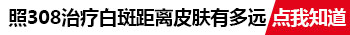 白癜风从发现到扩大需要多久