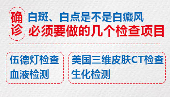 白斑出现一年多了最近好像大了一点