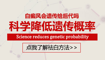 白癜风会遗传给下一代吗 遗传几率有多大