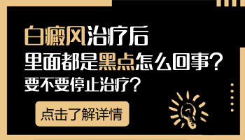 白斑开始长黑点了要多久才能彻底康复