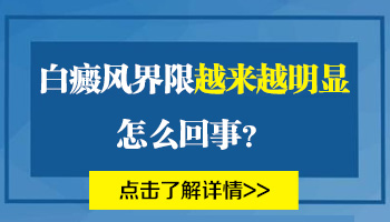 白癜风有明显界限代表什么