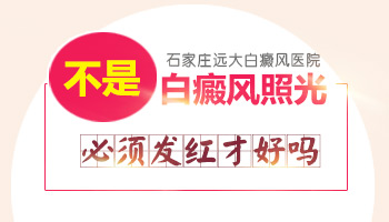 光疗后白斑发红才有效吗 不红就没效果吗