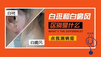 白斑和白癜风的区别图