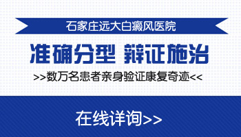 白癜风都有哪些类型 怎么区分白斑类型