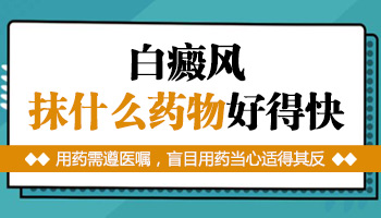 白癜风涂药膏后更白了怎么回事