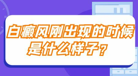 白癜风刚出现的时候是什么样的症状