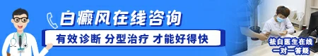 白癜风变成云白色是病情严重了吗