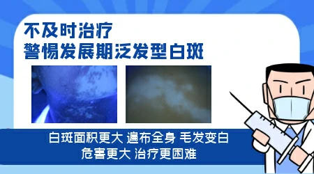 白癜风由浅白到瓷白要多久