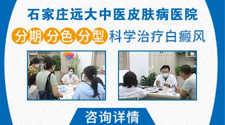 白癜风皮肤边缘图