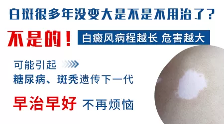 白癜风20年没变大还会变大吗
