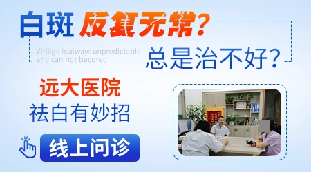 白斑部位毛发变白否代表病情加重