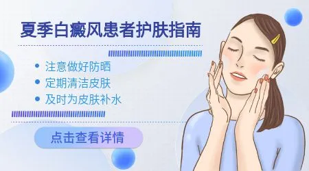 大量出汗会不会影响白癜风照激光的效果