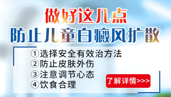 夏季幼儿白癜风防扩散的方法都有哪些