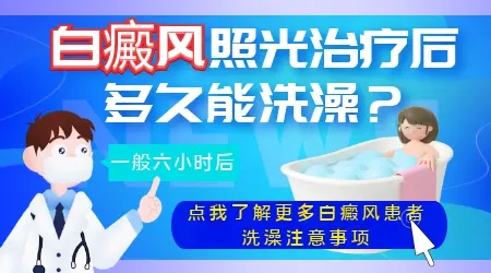 白癜风做照光当天可以洗澡吗