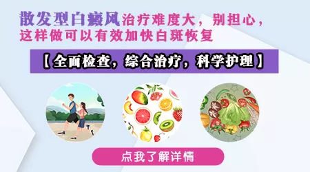 得散发型白癜风需要怎么治