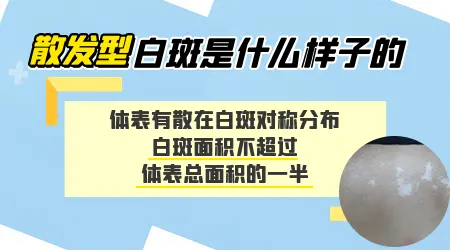 身上多处散在白斑是什么类型