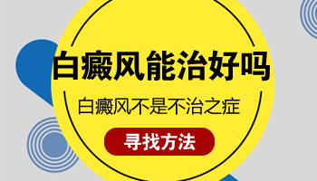 手脚都有白癜风还能治好不 能照光不