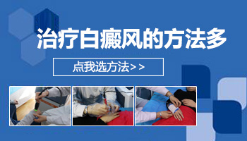 肢端型白癜风快20年了治疗过效果不好怎么办