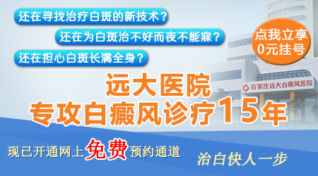 手腕和腿部白癜风一年多了怎么治