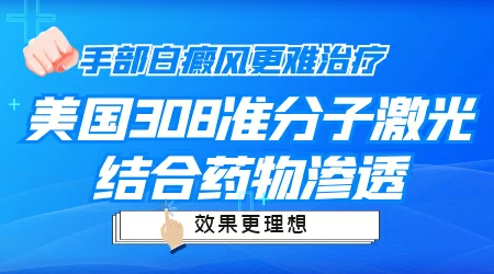 怎样治疗手上的白癜风好转快