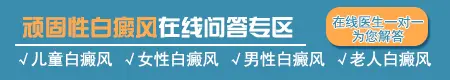 肢端型白癜风的治疗方法都有哪些 白癜风治好案例